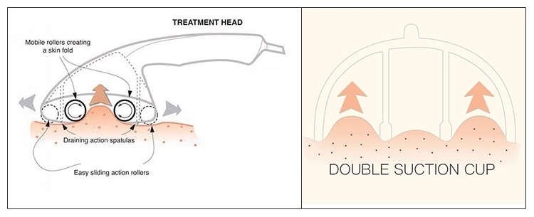 lymphatic massage9.png