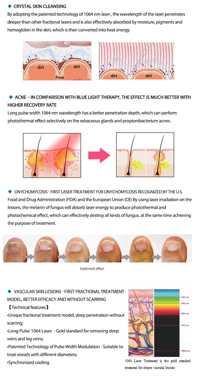长脉冲_01 (4).jpg